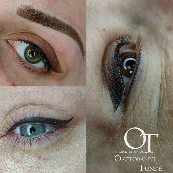Felső - és alsó szemhéj kontúr